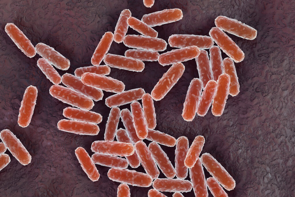 What to know about pneumonic plague after woman in Russia dies from mysterious illness