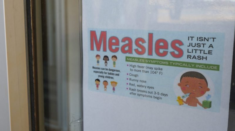 Single measles case prompts multi-county response across Ohio Valley