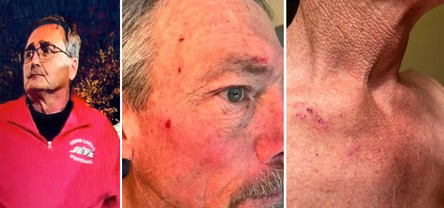Ohio school district agrees to $300K settlement stemming from Belmont County man’s claim that coach “violently attacked” him over halftime criticism